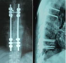 двойник фильма рентгеновского снимка 8 кс 10 дюймов медицинский сухой встал на сторону для АГФА Дрыстар \